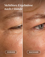 Vorher-Nachher-Ergebnis nach Anwendung der Aloe vera Augenpads