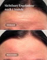 Frente Pad con aloe vera