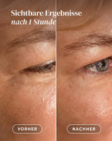 Pads para Contorno de Ojos y Sienes con Ectoína