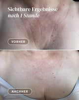 Almohadilla decolleté con ectoin