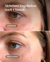 Pads para Contorno de Ojos y Sienes con Ectoína