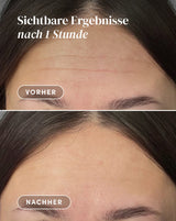 Frente Pad con aloe vera