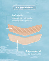Parches bucales con hialuron