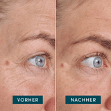 Pads para Contorno de Ojos y Sienes con Ectoína