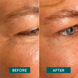 Almohadillas de templos de los ojos con aloe vera