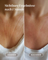 Pad para el Escote con Aloe Vera