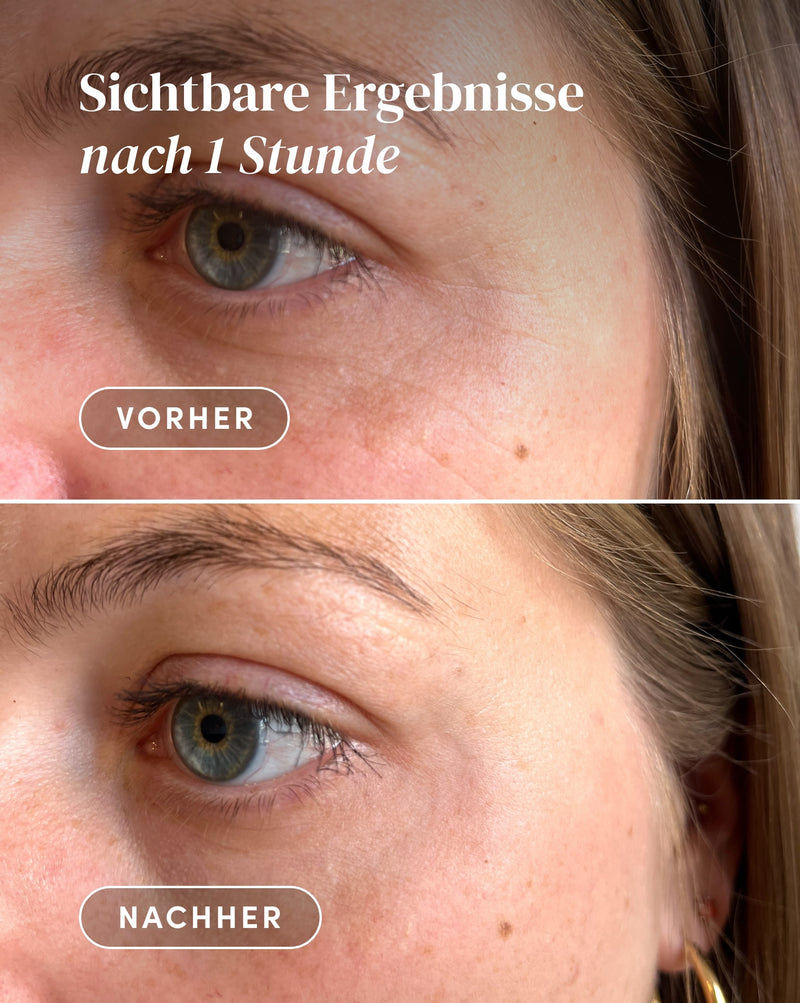 Pads para Contorno de Ojos y Sienes con Ectoína