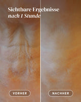 Pads para del cuello con hialurón