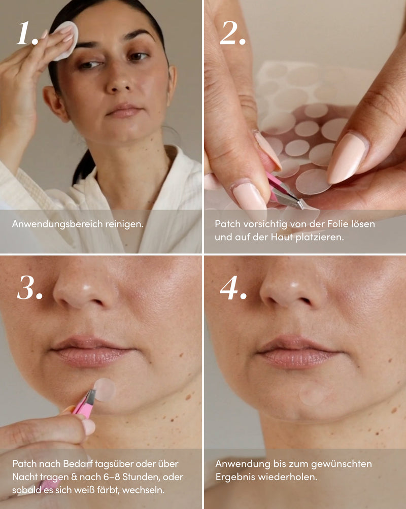 Parches para después de los granos