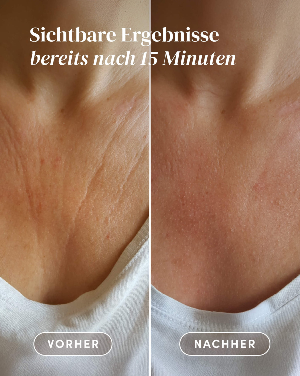 Vorher-Nachher-Ergebnis nach Anwendung des Vitamin C Dekolleté Pad