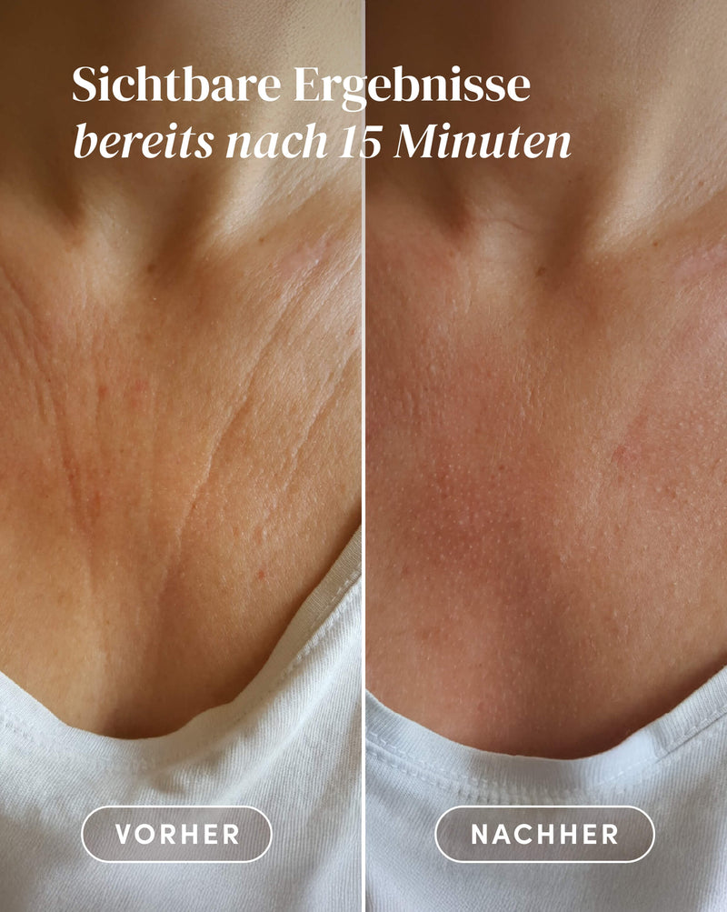 Pad para el Escote con Vitamina C